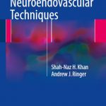 2017 Handbook of Neuroendovascular Techniques