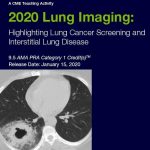 2020 Lung Imaging Highlighting Lung Screening and Interstitial Lung Disease – A Video CME Teaching Activity
