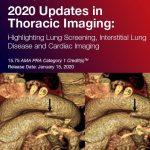 2020 Updates in Thoracic Imaging Highlighting Lung Screening, Interstitial Lung Disease, and Cardiac Imaging – A Video CME Teaching Activity