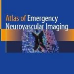 Atlas of Emergency neurovascular imaging 2020 PDF