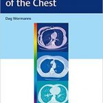 Diagnostic Imaging of the Chest 2020
