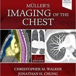 Muller’s Imaging of the Chest Expert Radiology Series 2e 2019