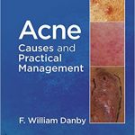 Acne Causes and Practical Managemen 2015