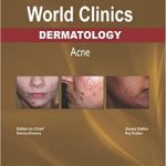 Acne (World Clinics in Dermatology)