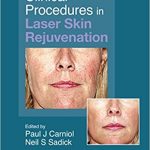 Clinical Procedures in Laser Skin Rejuvenation 2008