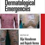Dermatological Emergencies3