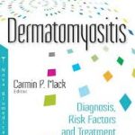 Dermatomyositis Diagnosis Risk Factors and Treatment Options 2017