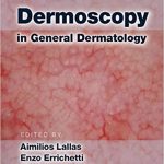 Dermoscopy in General Dermatology 2019