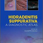 Hidradenitis Suppurativa A Diagnostic Atlas 2017