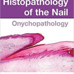 Histopathology of the Nail Onychopathology