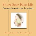 Short-Scar Face Lift Operative Strategies and Techniques, 1ed 2007