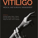 Vitiligo Medical and Surgical Management, 1ed + Video 2018