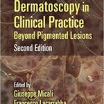 Dermatoscopy in Clinical Practice Beyond Pigmented Lesions