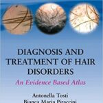 Diagnosis and Treatment of Hair Disorders An Evidence-Based Atlas