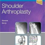 Shoulder Arthroplasty, 2e 2019 – PDF + VIDEOS