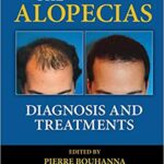 The Alopecias Diagnosis and Treatments