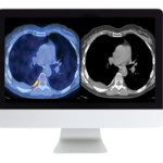Practical PET CT What You Need to Know 2020 Course_Video