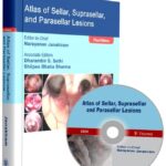 Atlas of Sellar, Suprasellar, and Parasellar Lesions 2020