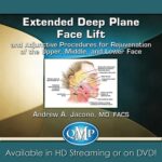 Extended Deep Plane Face Lift and Adjunctive Procedures for Rejuvenation of the Upper، Middle, and Lower Face 2018