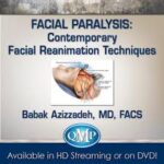 Facial Paralysis Contemporary Facial Reanimation Techniques