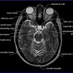 MRI Mastery Series Brain Anatomy Course-Video Price 15€x