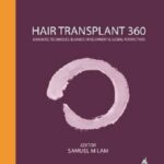 دانلود-کتاب-Hair-Transplant-360-Advances-Techniques-Business-Development-and-Global-Perspectives-1st-Edition