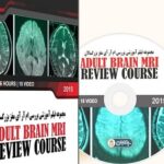 Adult Brain MRI Review Course 2015 Price 10€