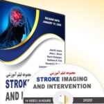 Stroke Imaging and Intervention Course-Video 2020 Price 15€