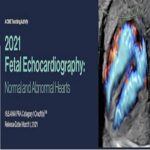 2021 Fetal Echocardiography Normal and Abnormal Hearts at 60€