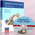 Ophthalmic Plastic Surgery Tricks of the Trade PDF+VIDEOS 2020 at 5€
