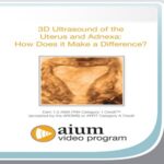 3D-Ultrasound-of-the-Uterus-and-Adnexa-How-Does-it-Make-a-Difference