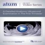 How-to-Perform-a-Detailed-Anatomic-Ultrasound-Examination-in-the-First-Trimester