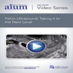 Pelvic-Ultrasound-Taking-it-to-the-Next-Level