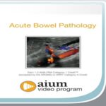 Point-of-Care Ultrasound Assessment of Acute Bowel Pathology at 20€