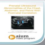 Prenatal-Ultrasound-Abnormalities-of-the-Chest-Abdomen-and-Pelvis-With-Postnatal-Correlation