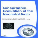 Sonographic-Evaluation-of-the-Neonatal-Brain