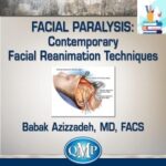 Facial Paralysis Contemporary Facial Reanimation Techniques at 50€