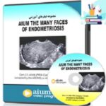 AIUM The Many Faces of Endometriosis at 10€
