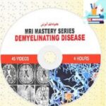 MRI Mastery Series Demyelinating Disease at 10€