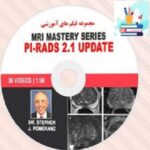 MRI Mastery Series PI-RADS 2.1 Update at 10€