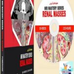 MRI Mastery Series Renal Masses at 10€