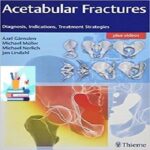 Acetabular Fractures Diagnosis Indications Treatment Strategies 1ed PDF+Video at 1€