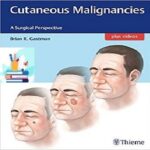 Cutaneous Malignancies A Surgical Perspective 1ed PDF+Video at 1€
