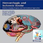 Hemorrhagic and Ischemic Stroke Medical Imaging Surgical and Interventional Approaches 1ed PDF+Videos at 2€
