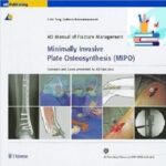 Minimally Invasive Plate Osteosynthesis (MIPO) 1ed PDF+VIDEO at 1€