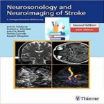 Neurosonology and Neuroimaging of Stroke 2ed PDF+Video at 2€