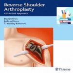 Reverse Shoulder Arthroplasty A Practical Approach 1ed PDF+Video at €2