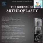 The Journal of Arthroplasty 2021 Full Archives at 25€