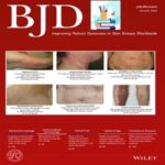 British Journal of Dermatology 2022