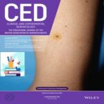 Clinical and Experimental Dermatology